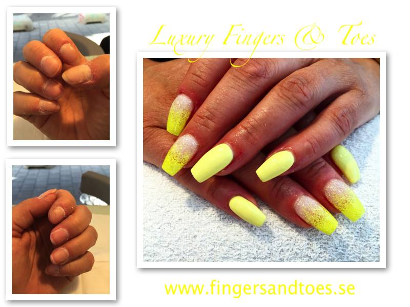 fingers&toes